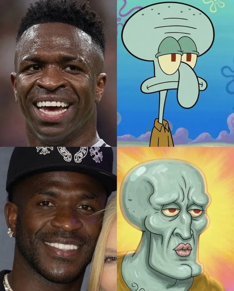 Vinicius przed operacją plastyczną vs Vinicius po operacji plastycznej XD
